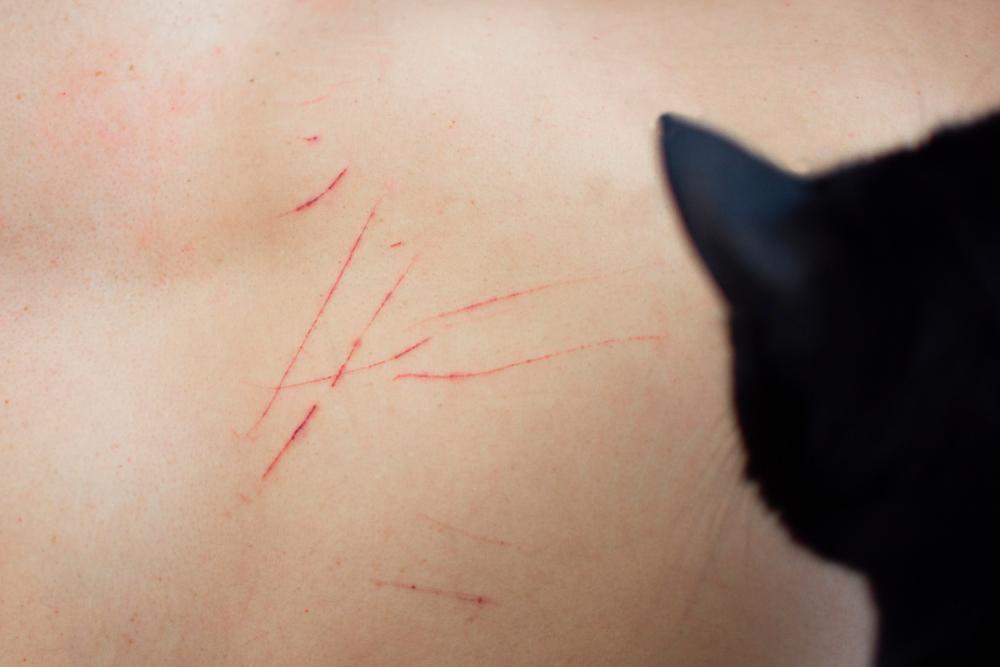 Как отучить кошку царапаться Как отучить кошку царапаться