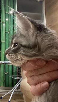 Девочка полидакт